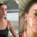 Mulher processa 'guru de cuidados com a pele' por danos faciais