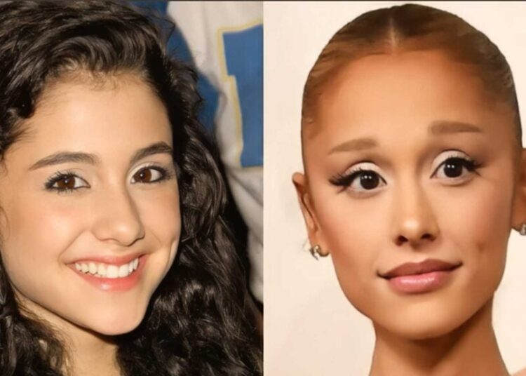10 celebridades que não se parecem em nada com antes
