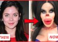 45 Celebrity Plastic Surgery Fails That Ruined Their Fame | Then and Now 2026