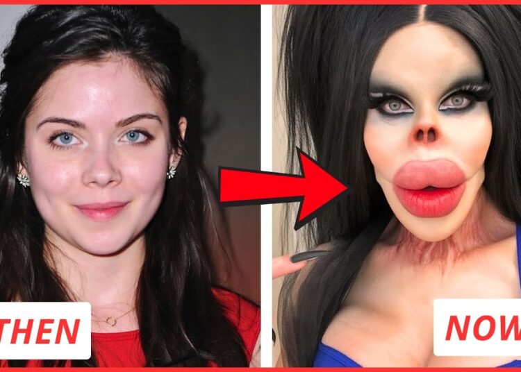 45 Celebrity Plastic Surgery Fails That Ruined Their Fame | Then and Now 2026