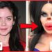 45 Celebrity Plastic Surgery Fails That Ruined Their Fame | Then and Now 2026