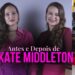 Como Kate Middleton Mudou o Estilo? Antes e Depois da Realeza #dupladoestilo
