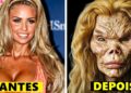 CELEBRIDADES FAMOSAS QUE ARRUINARAM COMPLETAMENTE SEUS ROSTOS COM CIRURGIA PLÁSTICA!