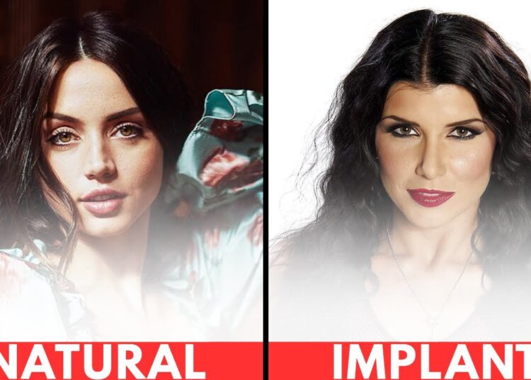 BIG B**BS LOVE STARS NATURAL VS IMPLANT