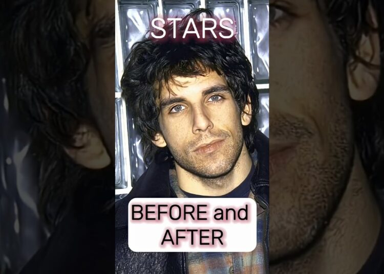 STARS | BEFORE and AFTER #stars #celebritytransformation#hollywood #25yearslater #beforeandafter