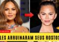 10 Estrelas de Hollywood que Arruinaram o Rosto com a Remoção de Gordura Bucal | Antes e Depois 2025