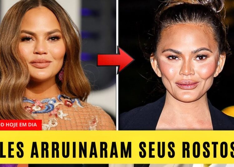 10 Estrelas de Hollywood que Arruinaram o Rosto com a Remoção de Gordura Bucal | Antes e Depois 2025