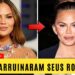 10 Estrelas de Hollywood que Arruinaram o Rosto com a Remoção de Gordura Bucal | Antes e Depois 2025