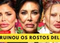 7 Celebridades Antes e Depois da Cirurgia Plástica | Transformações Inacreditáveis 2025