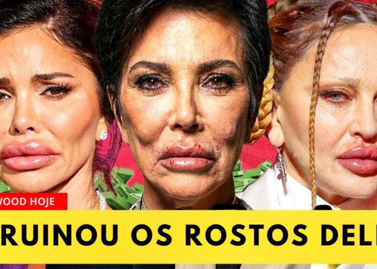 7 Celebridades Antes e Depois da Cirurgia Plástica | Transformações Inacreditáveis 2025