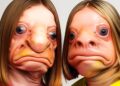 20 Cirurgias Plásticas Que Fizeram Celebridades Não Se Reconhecerem Mais #CirurgiaPlástica P2