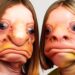 20 Cirurgias Plásticas Que Fizeram Celebridades Não Se Reconhecerem Mais #CirurgiaPlástica P2