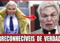 10 Cirurgias Plásticas Que Fizeram Celebridades Perderem O Próprio Rosto (Choque Total!)