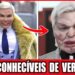 10 Cirurgias Plásticas Que Fizeram Celebridades Perderem O Próprio Rosto (Choque Total!)