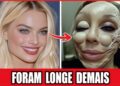 21 Cirurgias Plásticas Que Arruinaram A Aparência De Celebridades | Antes E Depois 2026!