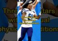 Three nfl stars with unusual physical conditions#shorts#celebrity#youtubeshorts#nfl