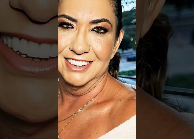 Margareth revela sequela do ac1dent3 #famosos #fofocas #noticias
