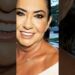 Margareth revela sequela do ac1dent3 #famosos #fofocas #noticias