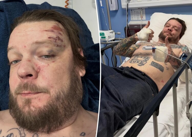 Corey Harrison, do Pawn Stars, quebra 11 costelas em acidente de moto