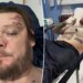 Corey Harrison, do Pawn Stars, quebra 11 costelas em acidente de moto