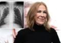 O que é dextrocardia? A rara doença cardíaca de Catherine O'Hara