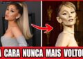 35 Estrelas Que Não Ousam Mais Olhar Para O Próprio Rosto Por Causa Do Ozempic!