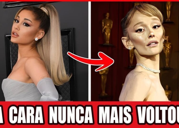 35 Estrelas Que Não Ousam Mais Olhar Para O Próprio Rosto Por Causa Do Ozempic!