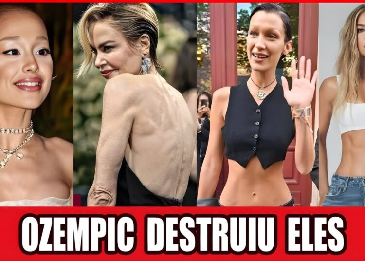 21 Estrelas De Hollywood “Destruídas” Pelo Ozempic: Beleza Rápida, Preço Alto!
