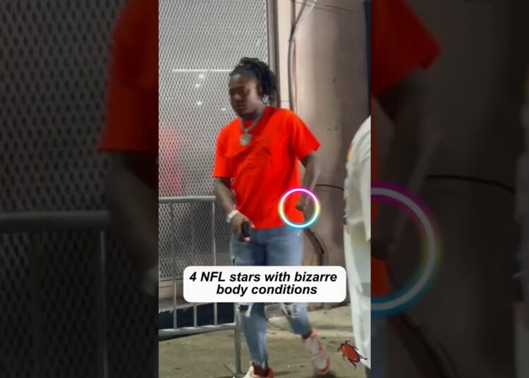 4 NFL Stars with bizarre body conditions#celebritynews #celebrity #viral #shorts #fyp