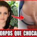 36 Famosos Com Estranhas Deformidades Corporais Que Chocaram o Público