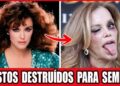 Cirurgias Plásticas de Famosos Que Deram Errado e Chocaram o Público