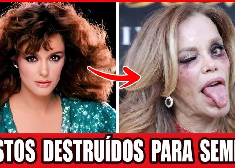 Cirurgias Plásticas de Famosos Que Deram Errado e Chocaram o Público