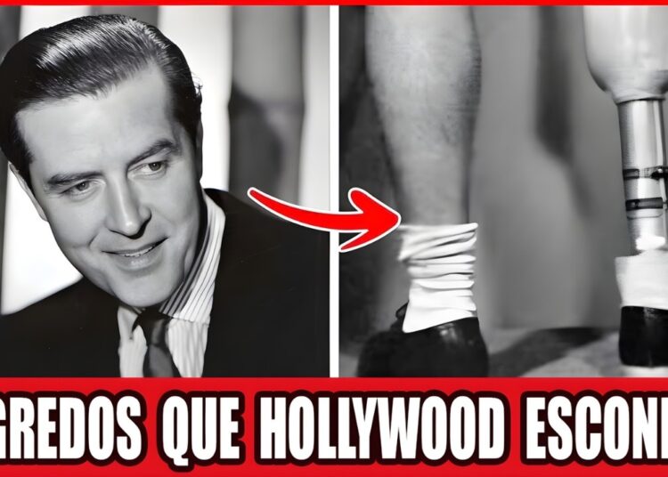 25 Celebridades da Era Dourada que Ocultaram Deformidades e Deficiências Chocantes!