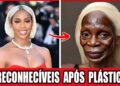25 Estrelas Negras Irreconhecíveis Depois de Cirurgias Plásticas Extremas!
