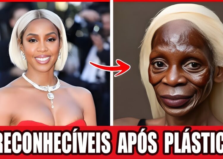 25 Estrelas Negras Irreconhecíveis Depois de Cirurgias Plásticas Extremas!