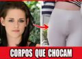 20 Celebridades Irreconhecíveis por Deformidades Corporais | Antes e Depois 2026!