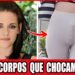 20 Celebridades Irreconhecíveis por Deformidades Corporais | Antes e Depois 2026!