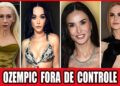 Ozempic Fora de Controle — Transformações Radicais de Celebridades Que Deram Muito Errado!