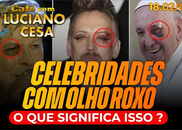 CELEBRIDADES com OLHO ROXO. O QUE ISSO SIGNIFICA? LUCIANO CESA CAFÉ. Compartilhem!