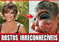 Top 20 Cirurgias Plásticas Terríveis De Celebridades Latinas Que Deram Errado!
