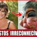 Top 20 Cirurgias Plásticas Terríveis De Celebridades Latinas Que Deram Errado!