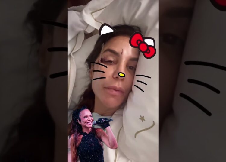 Momento tenso: Ivete Sangalo sofre acidente #fofoca #fofocas #famosos #shotstory #shotsviral #viral