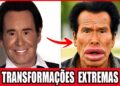 20 Principales Desastres De Cirugía Plástica Que Arruinaron Celebridades