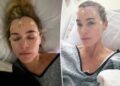 Teddi Mellencamp comemora primeiro aniversário de sua cirurgia no cérebro