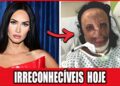 20 Celebridades Desfiguradas Por Cirurgias Plásticas Que Hoje Você Não Vai Reconhecer!