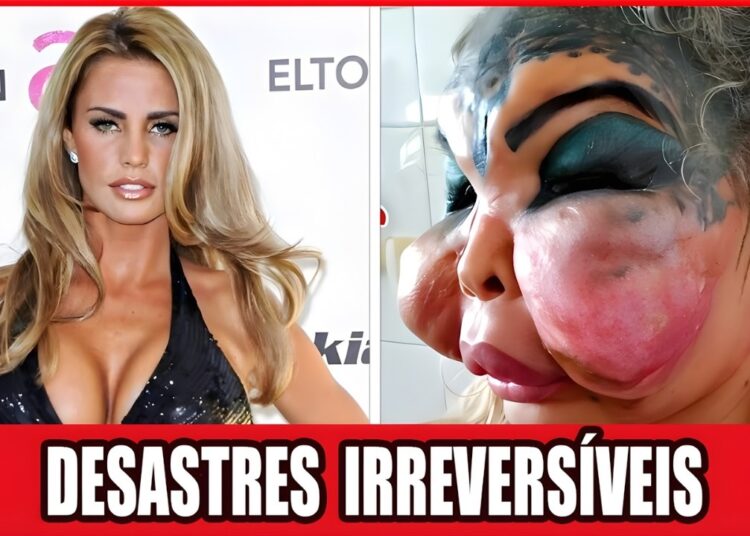 20 Desastres Chocantes De Cirurgia Plástica Em Celebridades | Antes E Depois 2026!