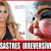 20 Desastres Chocantes De Cirurgia Plástica Em Celebridades | Antes E Depois 2026!