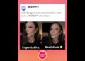 #ivetesangalo revela como está seu rosto após o ACIDENTE domestico. #fofocas #fofoca