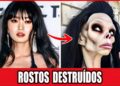 20 Principais Desastres Reais De Cirurgias Plásticas Em Celebridades Famosas!