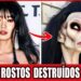 20 Principais Desastres Reais De Cirurgias Plásticas Em Celebridades Famosas!